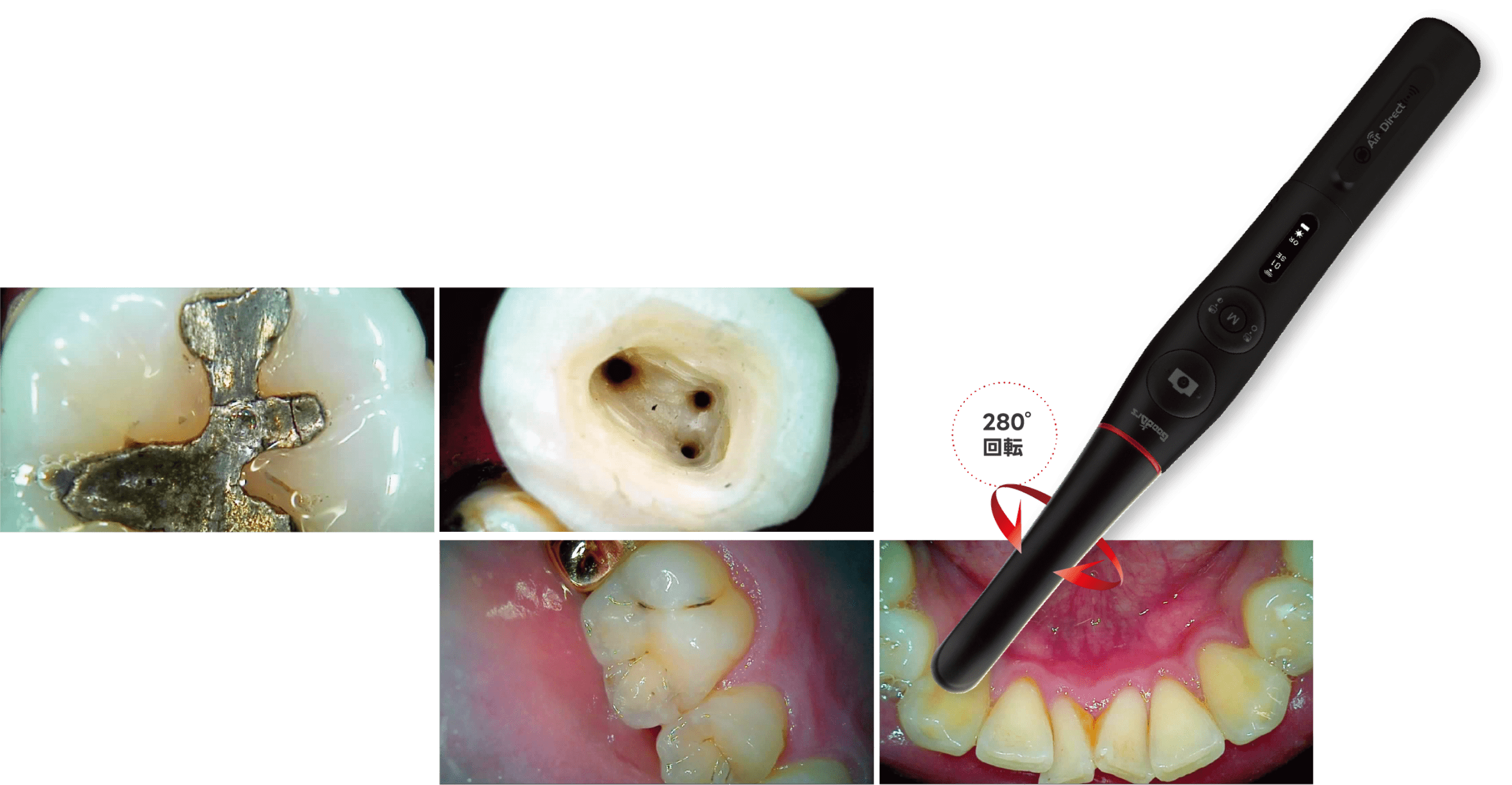 一歯ごとの接写から複数歯まで対応。ヘッド部分は280度回転。